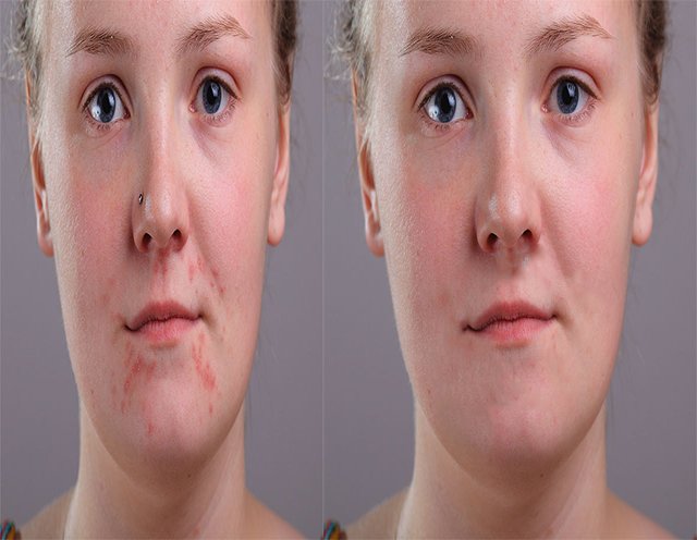 Photo Retouch